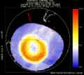 Auroral Activity Southern Hemisphere